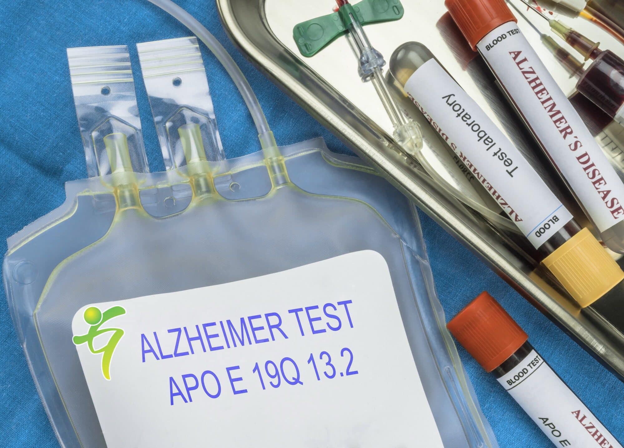 Bluttest zur schnellen Diagnose von Alzheimer