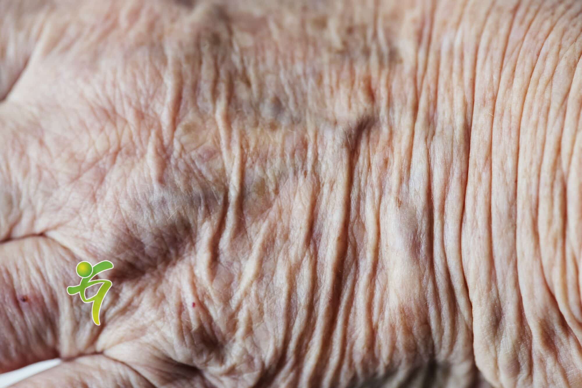 Die Alterung der Haut ist ein natürlicher Prozess, bei dem das Kollagen und Elastin, die unsere Haut straff und jugendlich aussehen lassen, abzunehmen beginnt, was zu Falten führt.